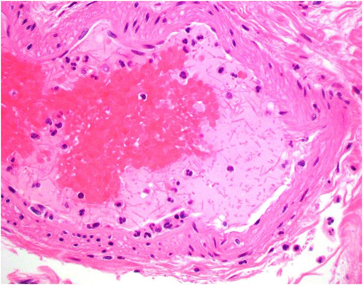 https://cdn.ncbi.nlm.nih.gov/pmc/blobs/df53/9288242/6c0cae8b6845/gr4_lrg.jpg
