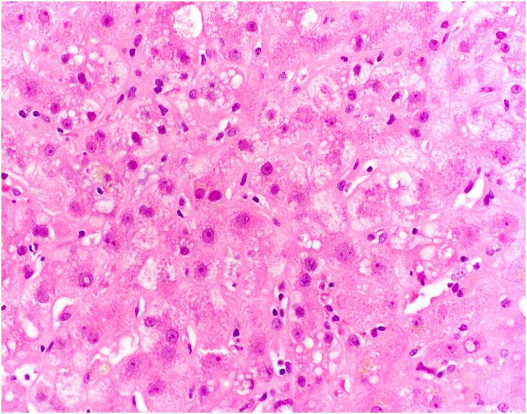 https://cdn.ncbi.nlm.nih.gov/pmc/blobs/df53/9288242/82cfe61b1d60/gr16_lrg.jpg