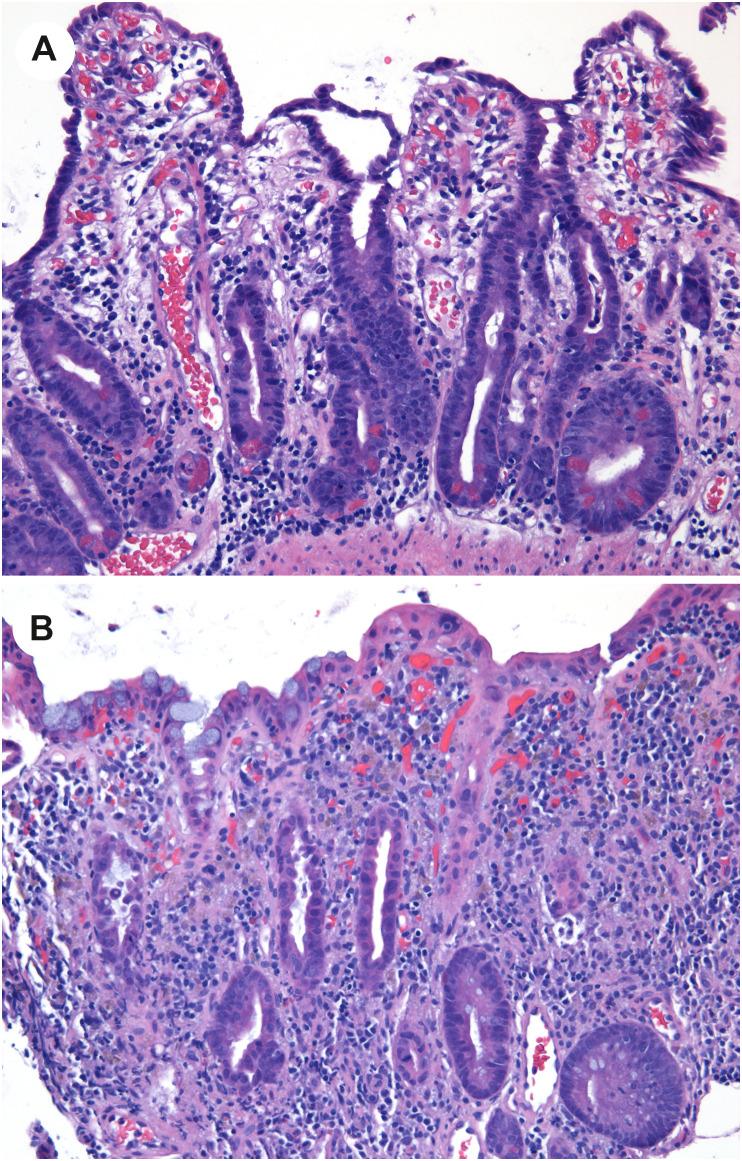 https://cdn.ncbi.nlm.nih.gov/pmc/blobs/df53/9288242/856dc66b5b49/gr8_lrg.jpg