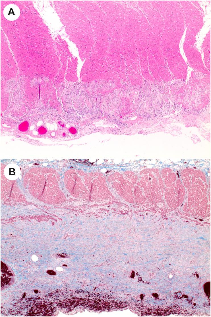 https://cdn.ncbi.nlm.nih.gov/pmc/blobs/df53/9288242/8db1ec7258b4/gr6_lrg.jpg