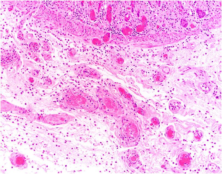 https://cdn.ncbi.nlm.nih.gov/pmc/blobs/df53/9288242/907ab1047a7a/gr2_lrg.jpg