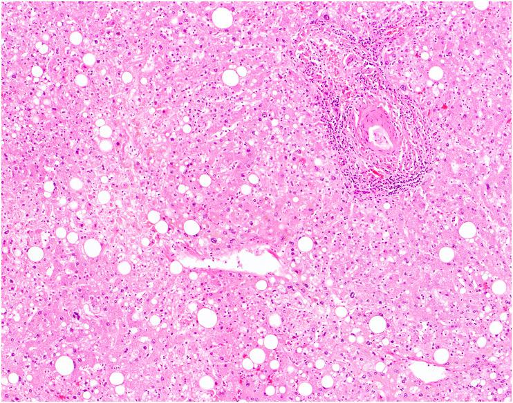 https://cdn.ncbi.nlm.nih.gov/pmc/blobs/df53/9288242/a51d9ec9ce40/gr9_lrg.jpg
