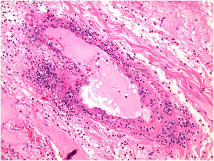 https://cdn.ncbi.nlm.nih.gov/pmc/blobs/df53/9288242/da3ddf054941/gr3_lrg.jpg