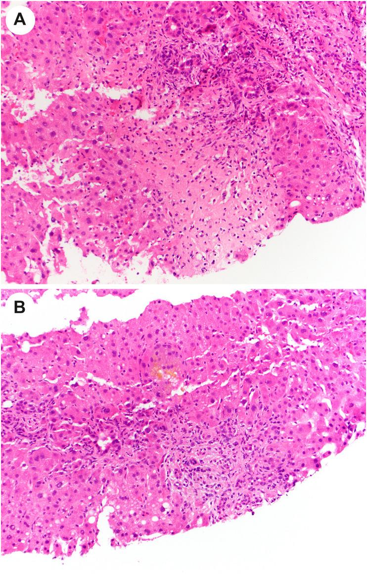 https://cdn.ncbi.nlm.nih.gov/pmc/blobs/df53/9288242/e0df93325ccf/gr17_lrg.jpg