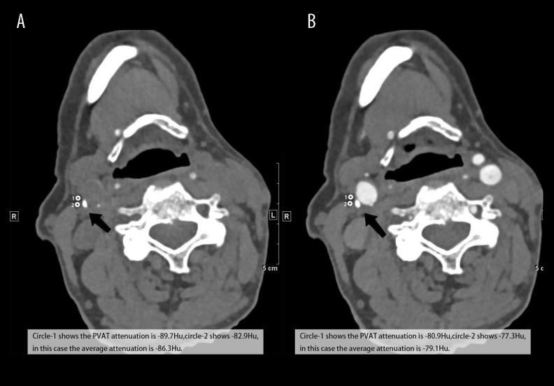 https://cdn.ncbi.nlm.nih.gov/pmc/blobs/df54/8650409/4c6d0c91dc01/medscimonit-27-e933351-g002.jpg