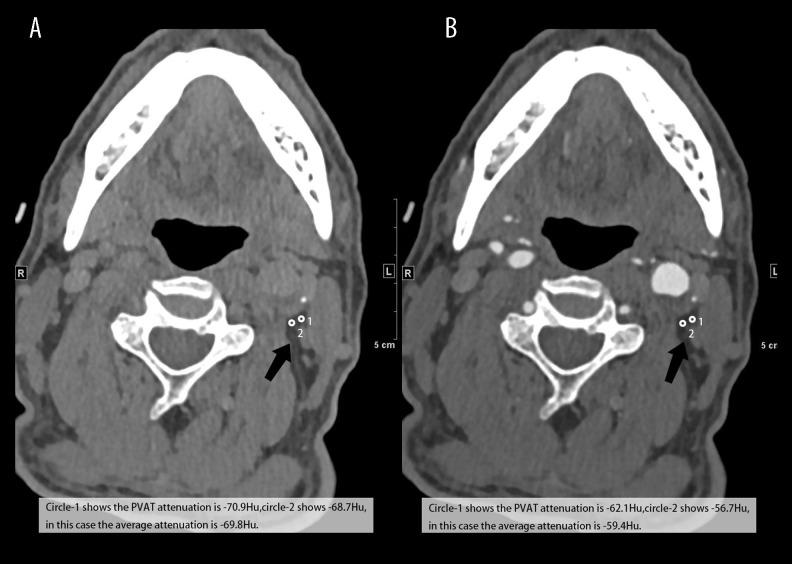https://cdn.ncbi.nlm.nih.gov/pmc/blobs/df54/8650409/de7fde343055/medscimonit-27-e933351-g001.jpg