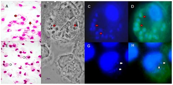 https://cdn.ncbi.nlm.nih.gov/pmc/blobs/df58/2972777/7d15fdf88ff8/pone.0013815.g001.jpg