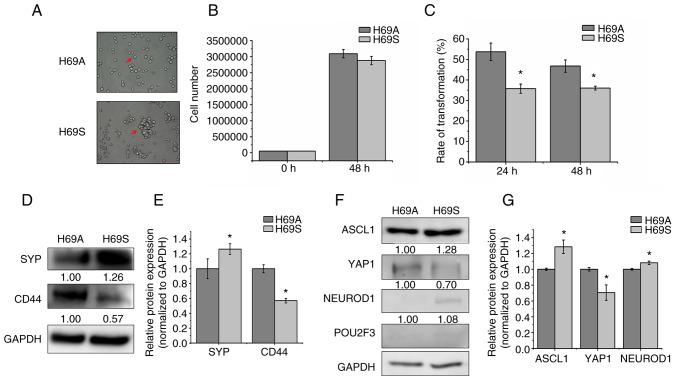 https://cdn.ncbi.nlm.nih.gov/pmc/blobs/df58/9164265/5112a4c6478c/or-48-01-08333-g00.jpg