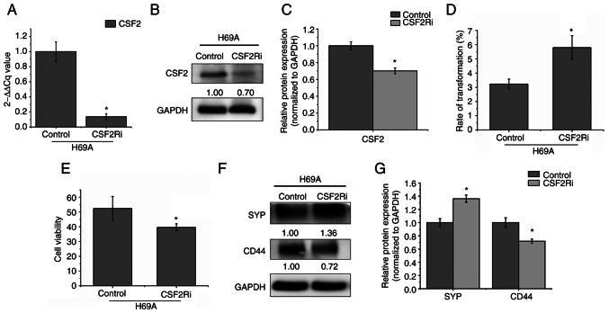 https://cdn.ncbi.nlm.nih.gov/pmc/blobs/df58/9164265/6a342b06d24e/or-48-01-08333-g05.jpg