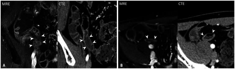 https://cdn.ncbi.nlm.nih.gov/pmc/blobs/df5c/8484150/108a4b266b0c/kjr-22-1640-g004.jpg