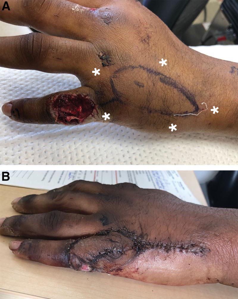 https://cdn.ncbi.nlm.nih.gov/pmc/blobs/df62/9839302/1cd5eef8018d/gox-11-e4756-g005.jpg