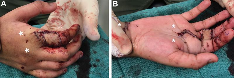 https://cdn.ncbi.nlm.nih.gov/pmc/blobs/df62/9839302/441b091705af/gox-11-e4756-g001.jpg