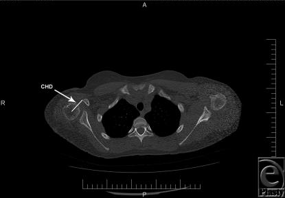 https://cdn.ncbi.nlm.nih.gov/pmc/blobs/df63/2990465/243f9fa4e767/eplasty10e67_fig4.jpg