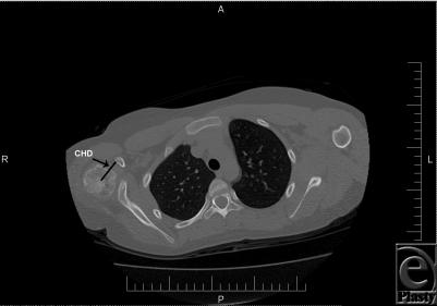 https://cdn.ncbi.nlm.nih.gov/pmc/blobs/df63/2990465/ec9aec29761f/eplasty10e67_fig3.jpg