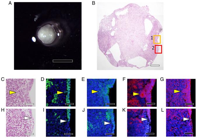 https://cdn.ncbi.nlm.nih.gov/pmc/blobs/df64/9257972/55ae5765b8cb/etm-24-02-11476-g07.jpg