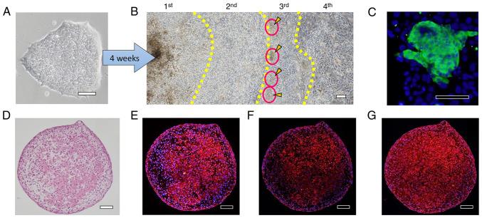 https://cdn.ncbi.nlm.nih.gov/pmc/blobs/df64/9257972/da4a55bfe59d/etm-24-02-11476-g08.jpg
