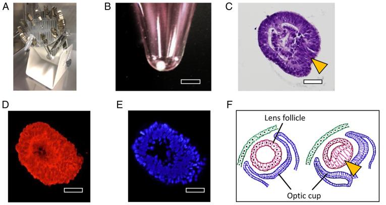 https://cdn.ncbi.nlm.nih.gov/pmc/blobs/df64/9257972/fa760299cb27/etm-24-02-11476-g04.jpg