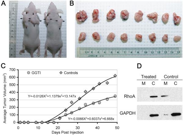 https://cdn.ncbi.nlm.nih.gov/pmc/blobs/df65/3639152/3d85ddf004c7/1471-2407-13-198-5.jpg
