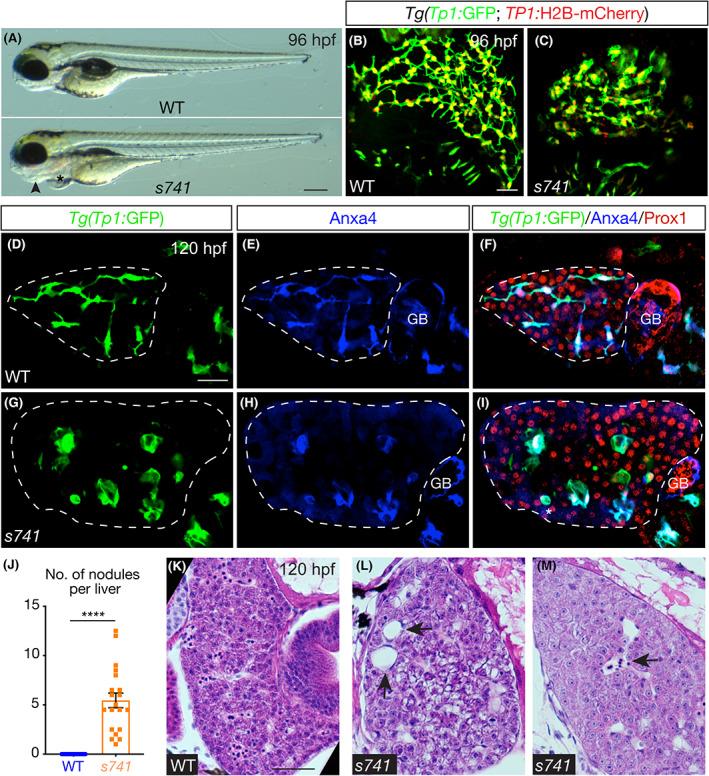 https://cdn.ncbi.nlm.nih.gov/pmc/blobs/df65/9592797/0af13d6fb8d3/HEP4-6-3083-g005.jpg