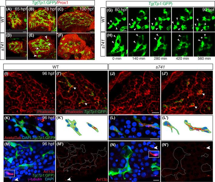 https://cdn.ncbi.nlm.nih.gov/pmc/blobs/df65/9592797/8c20165b5a51/HEP4-6-3083-g002.jpg