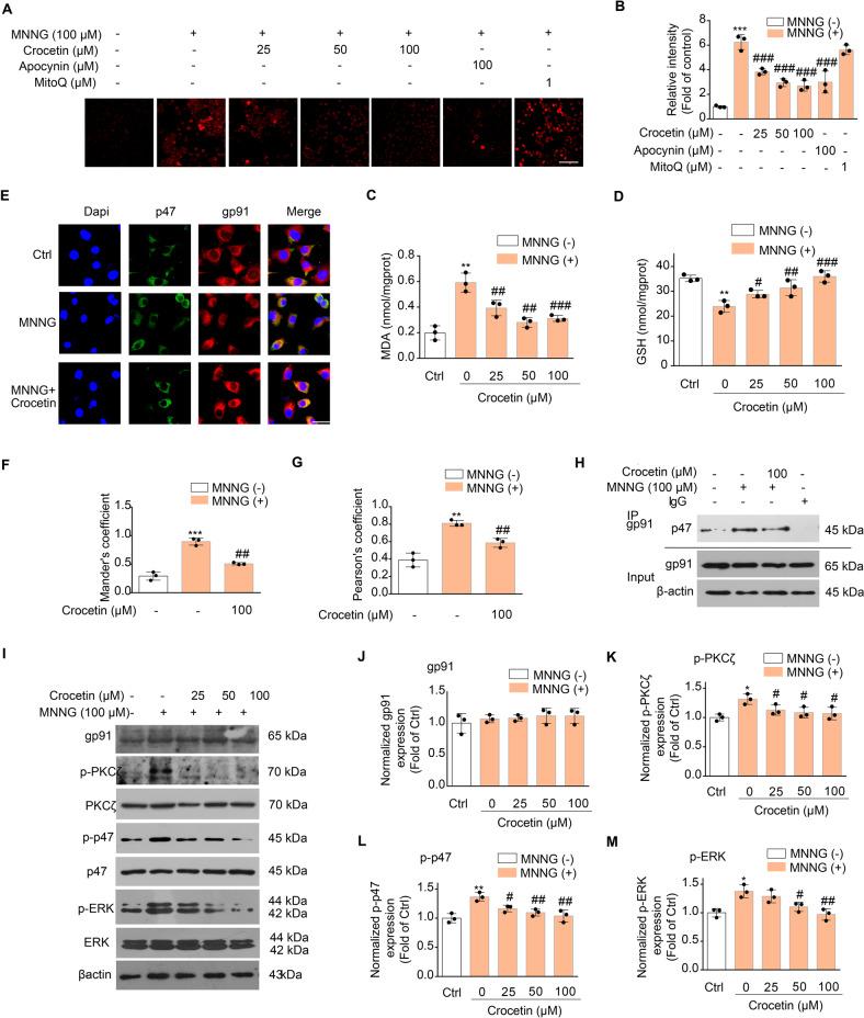 https://cdn.ncbi.nlm.nih.gov/pmc/blobs/df6b/9867762/9d2a3707aace/41419_2023_5581_Fig5_HTML.jpg