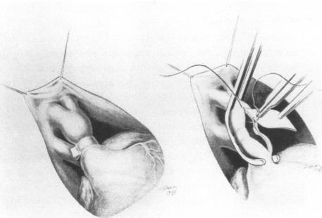 https://cdn.ncbi.nlm.nih.gov/pmc/blobs/df6d/326189/92d482683e4a/thij00046-0072-a.jpg