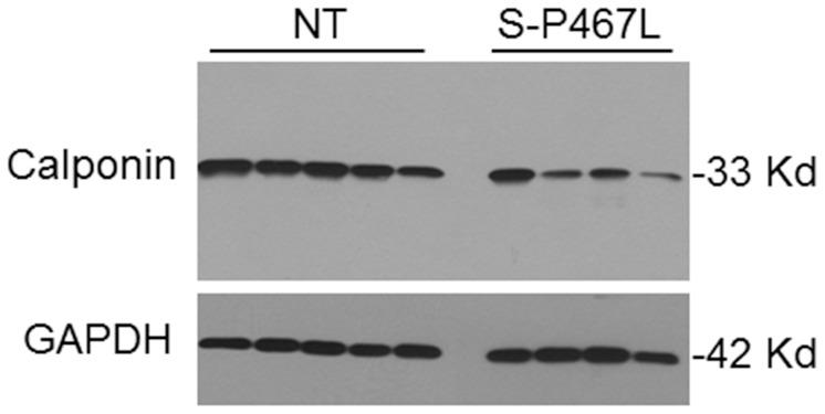 https://cdn.ncbi.nlm.nih.gov/pmc/blobs/df70/4133177/13136e160cd8/pone.0103786.g002.jpg