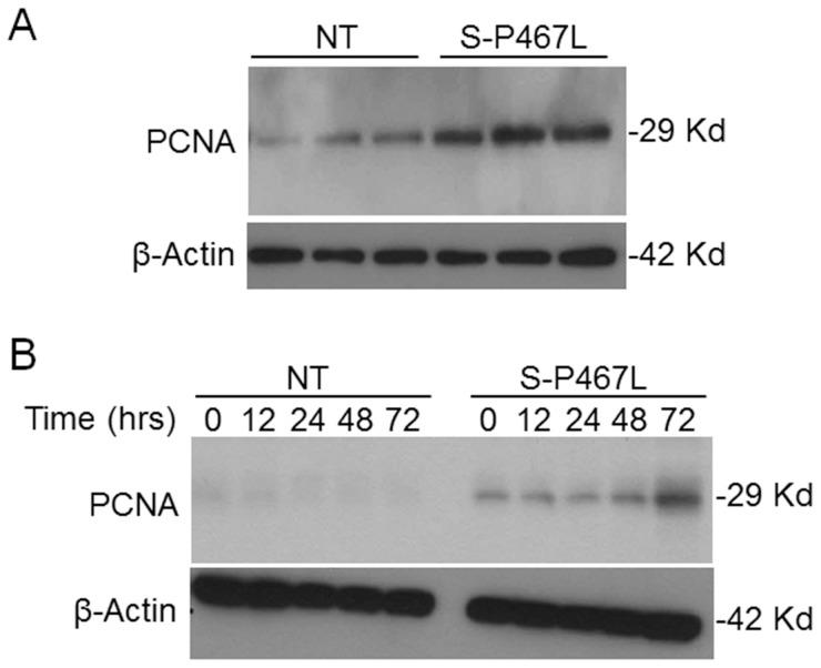 https://cdn.ncbi.nlm.nih.gov/pmc/blobs/df70/4133177/1c74e5f190a1/pone.0103786.g003.jpg