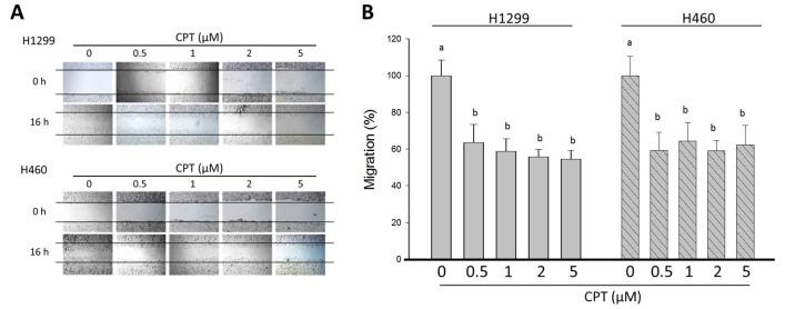 https://cdn.ncbi.nlm.nih.gov/pmc/blobs/df70/6192723/77fac2a23a18/IJO-53-05-1967-g01.jpg