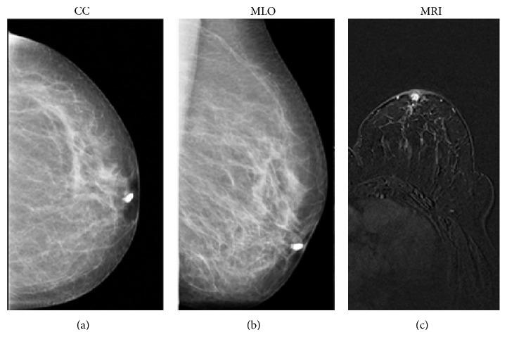 https://cdn.ncbi.nlm.nih.gov/pmc/blobs/df73/4317598/5390db0bec12/BMRI2015-806368.004.jpg