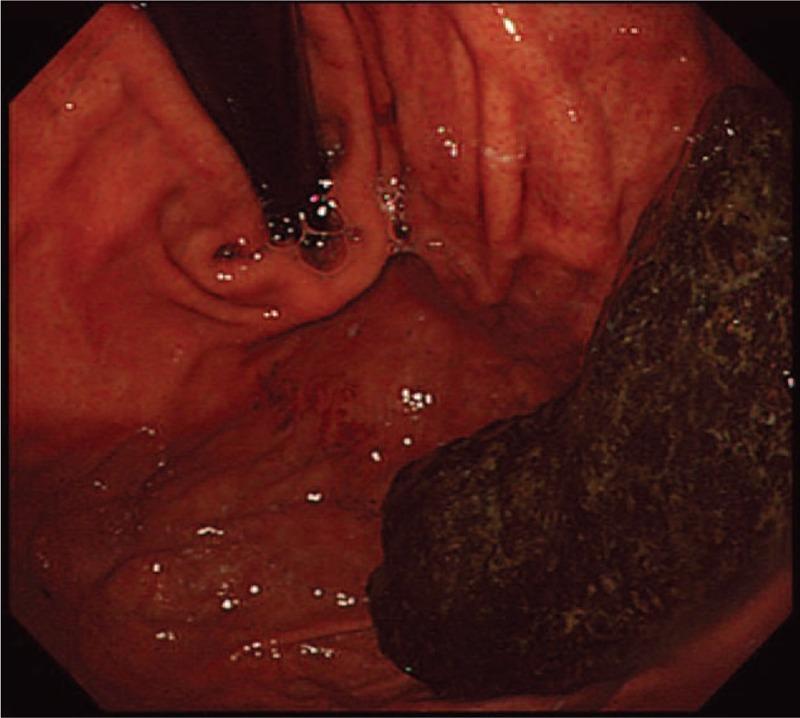 https://cdn.ncbi.nlm.nih.gov/pmc/blobs/df73/6076189/d51885ddff39/medi-97-e11320-g001.jpg
