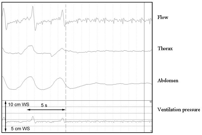 https://cdn.ncbi.nlm.nih.gov/pmc/blobs/df75/3199800/d2423f1a00f7/CTO-05-06-g-020.jpg
