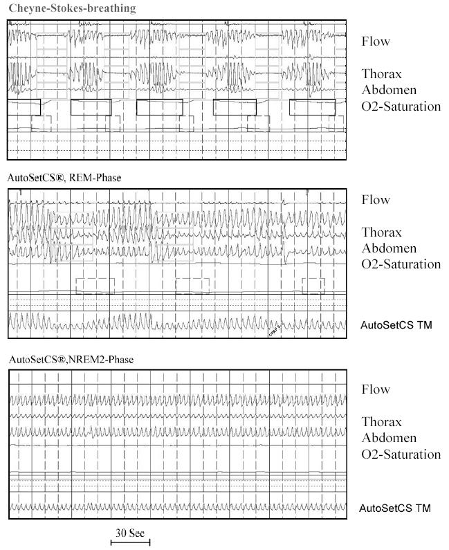 https://cdn.ncbi.nlm.nih.gov/pmc/blobs/df75/3199800/f6aeacf583bd/CTO-05-06-g-018.jpg