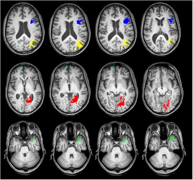 https://cdn.ncbi.nlm.nih.gov/pmc/blobs/df75/6338779/2d1422131f53/41598_2018_36818_Fig2_HTML.jpg