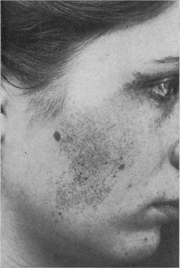 https://cdn.ncbi.nlm.nih.gov/pmc/blobs/df83/1864367/2e994b1eeef1/procrsmed00037-0025-a.jpg