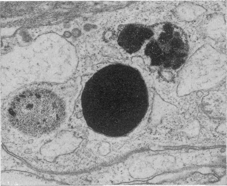 https://cdn.ncbi.nlm.nih.gov/pmc/blobs/df83/1864367/ee7a7e597026/procrsmed00037-0026-d.jpg