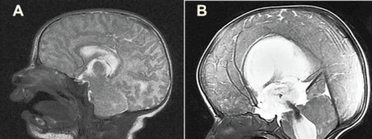 https://cdn.ncbi.nlm.nih.gov/pmc/blobs/df86/5329758/82d3c4cdbfbd/ijcn-11-037-g002.jpg