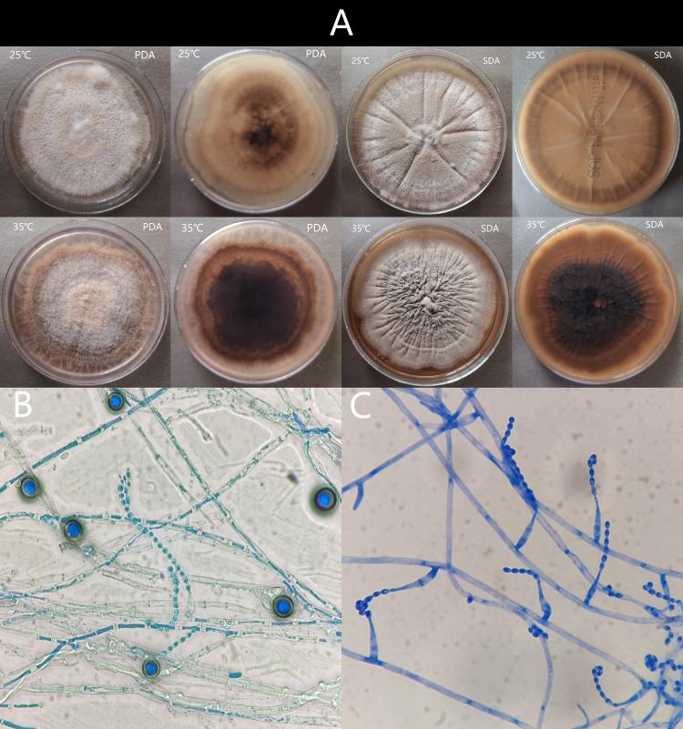 https://cdn.ncbi.nlm.nih.gov/pmc/blobs/df8b/11146340/67a215e4d412/IDR-17-2183-g0003.jpg