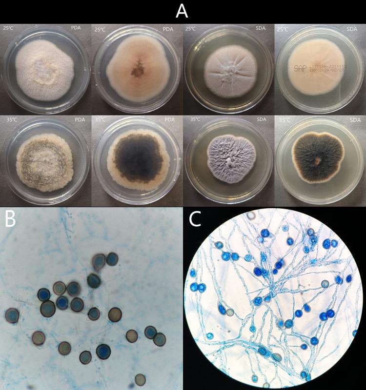 https://cdn.ncbi.nlm.nih.gov/pmc/blobs/df8b/11146340/de09f2f9b042/IDR-17-2183-g0002.jpg