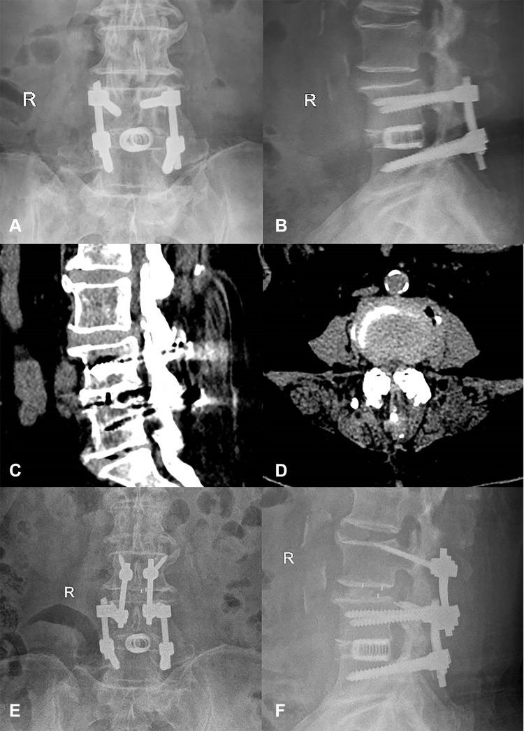 https://cdn.ncbi.nlm.nih.gov/pmc/blobs/df97/8313433/f39e23bf5f25/CIA-16-1403-g0003.jpg