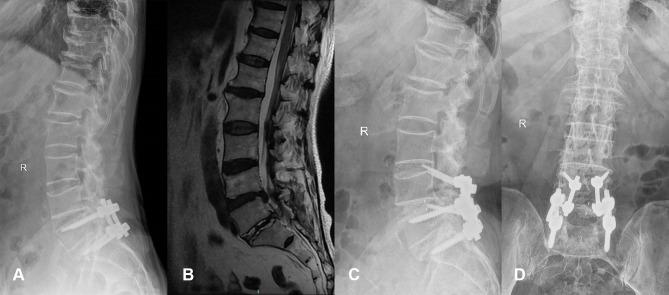 https://cdn.ncbi.nlm.nih.gov/pmc/blobs/df97/8313433/fe0e0edcbd58/CIA-16-1403-g0004.jpg