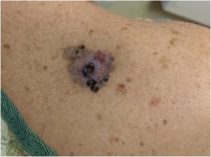 https://cdn.ncbi.nlm.nih.gov/pmc/blobs/df9d/9207090/187e01455c6d/gr3.jpg