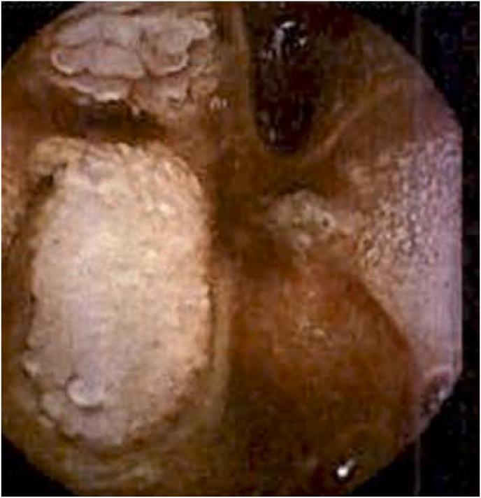 https://cdn.ncbi.nlm.nih.gov/pmc/blobs/df9d/9207090/8f36be18855f/gr2.jpg