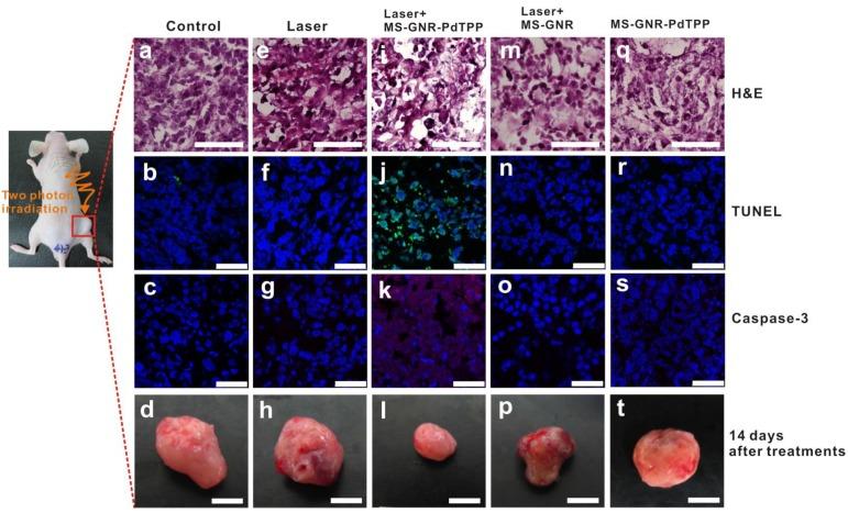https://cdn.ncbi.nlm.nih.gov/pmc/blobs/dfac/4063978/f4663a5605ac/thnov04p0798g007.jpg