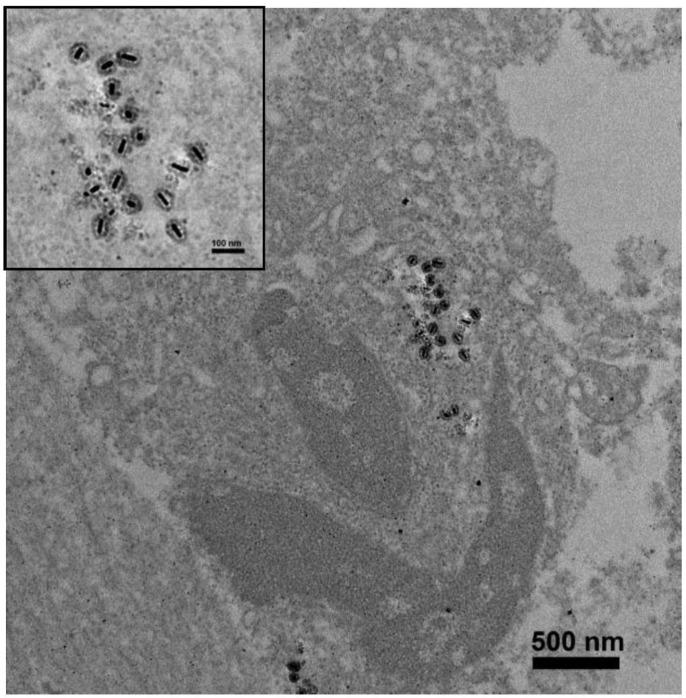 https://cdn.ncbi.nlm.nih.gov/pmc/blobs/dfac/4063978/f750f65d4675/thnov04p0798g006.jpg