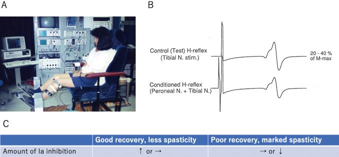https://cdn.ncbi.nlm.nih.gov/pmc/blobs/dfae/11153077/a3a22abd4b87/2188-2126-69-6-0446-g005.jpg