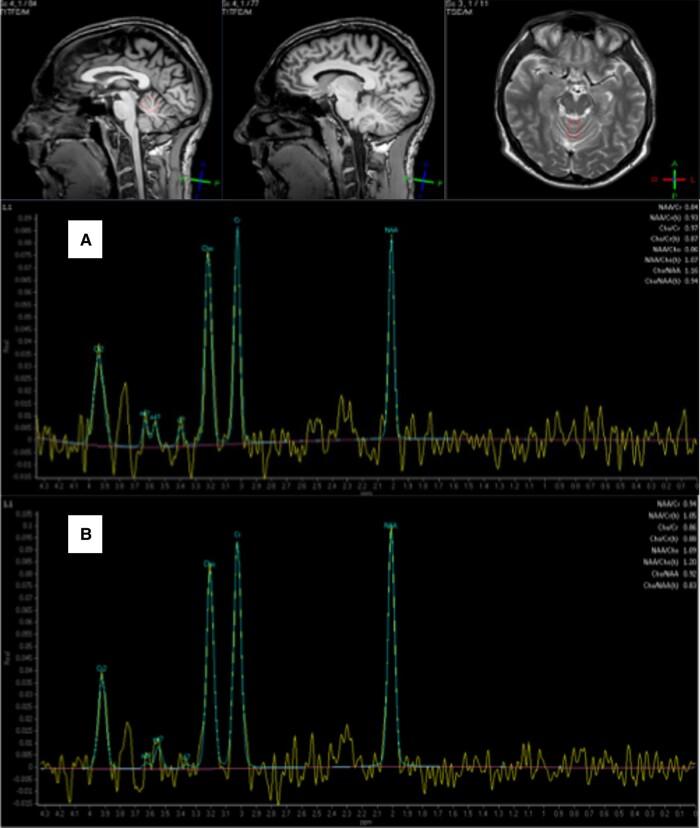 https://cdn.ncbi.nlm.nih.gov/pmc/blobs/dfb3/10953628/43fdaefb7a58/fcae078f1.jpg