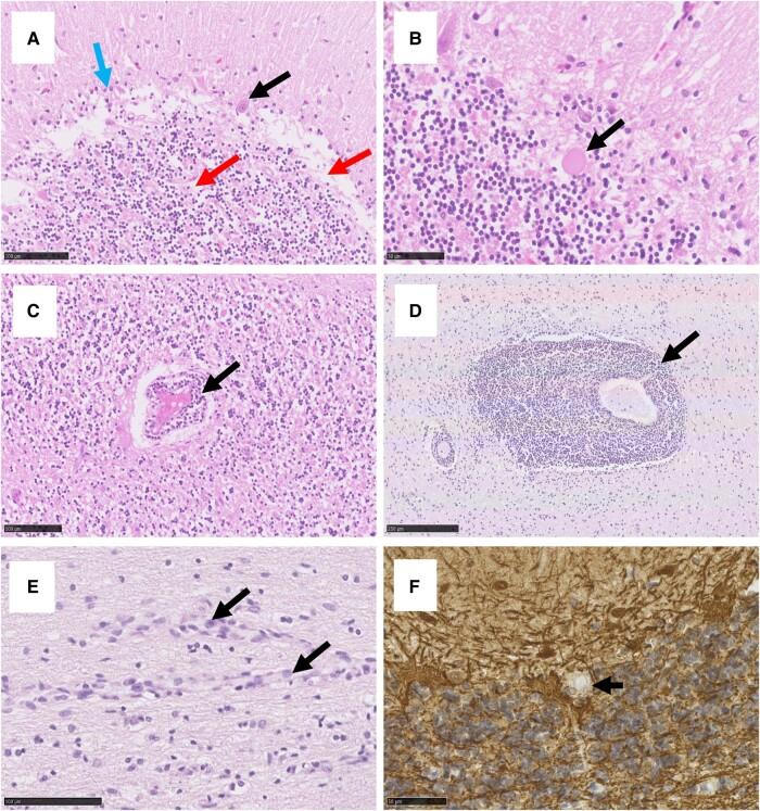 https://cdn.ncbi.nlm.nih.gov/pmc/blobs/dfb3/10953628/f73043d1863f/fcae078f2.jpg
