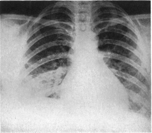 https://cdn.ncbi.nlm.nih.gov/pmc/blobs/dfb5/2039667/064c616d438b/brmedj03579-0011-a.jpg