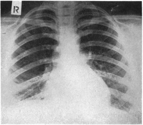 https://cdn.ncbi.nlm.nih.gov/pmc/blobs/dfb5/2039667/926bded44706/brmedj03579-0011-b.jpg